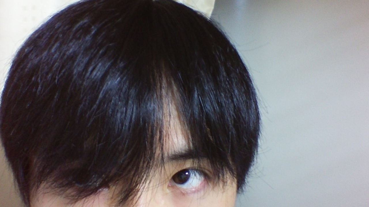 まとめテスト速報なんですが 19歳m字ハゲだけど辛すぎワロタ