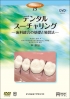 デンタルスーチャリングDVD