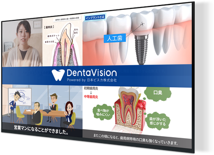Denta Visoon