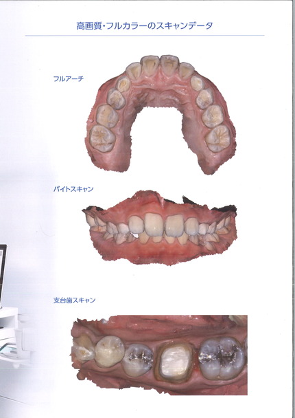 コエックスi5001