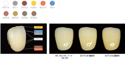 ヌールコート1