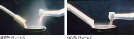 KaVoバキューム