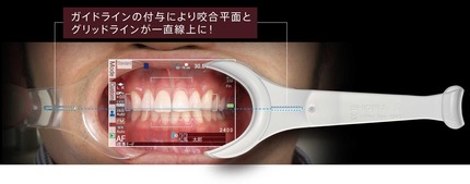 口腔内撮影用キット1