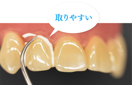 パナビアベニアLC1