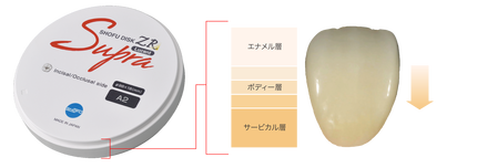 ¥¹¡¼¥×¥é