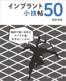 インプラント小技帖50