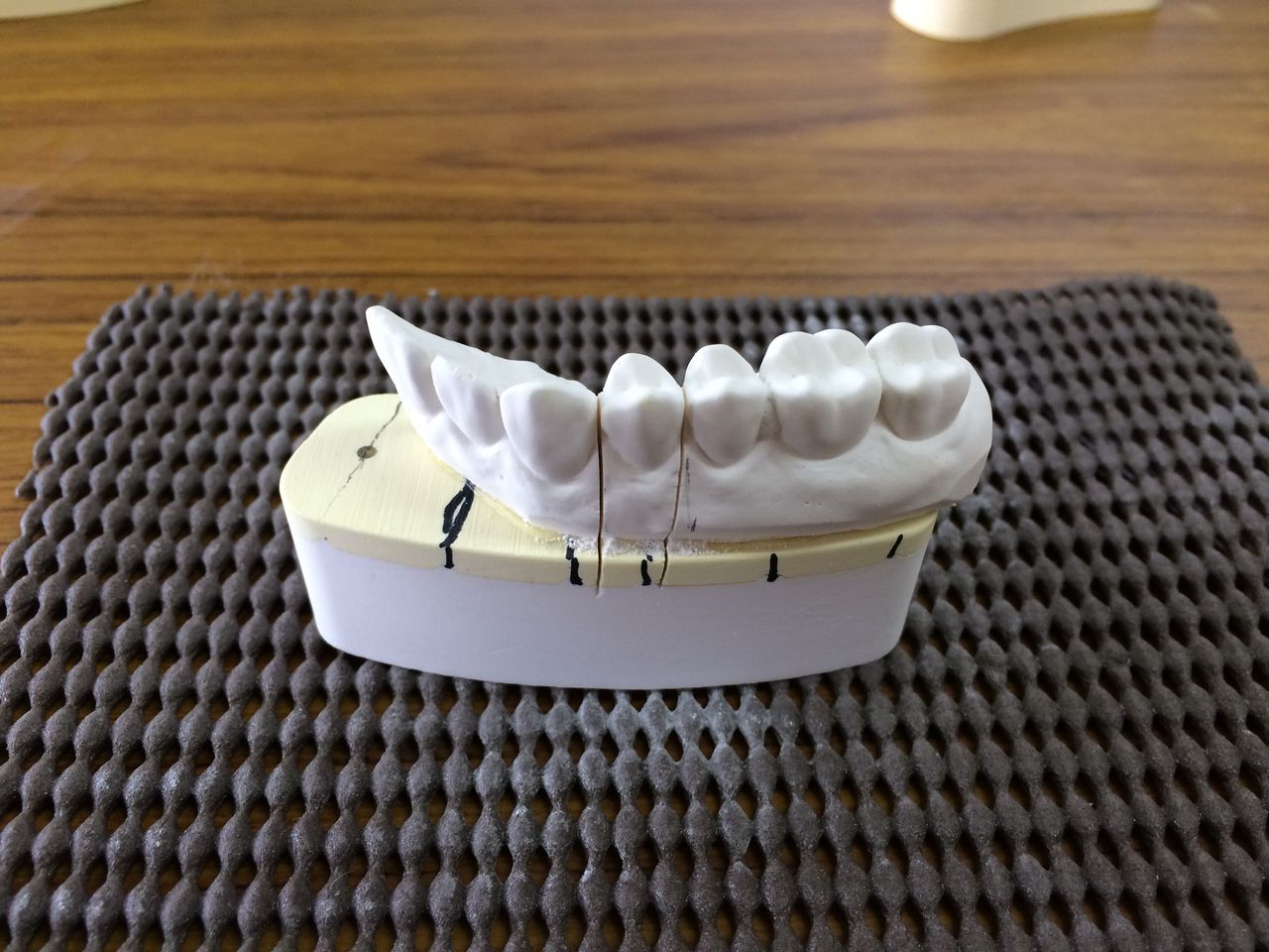 ☆[新品/未開封]◇だいちゃん 貼付模型【サンエス石膏株式会社】 歯科