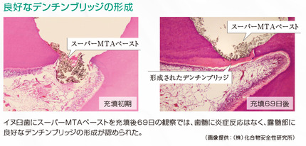 スーパーMTAペースト2