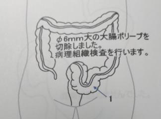 23452312