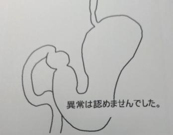 a3a3