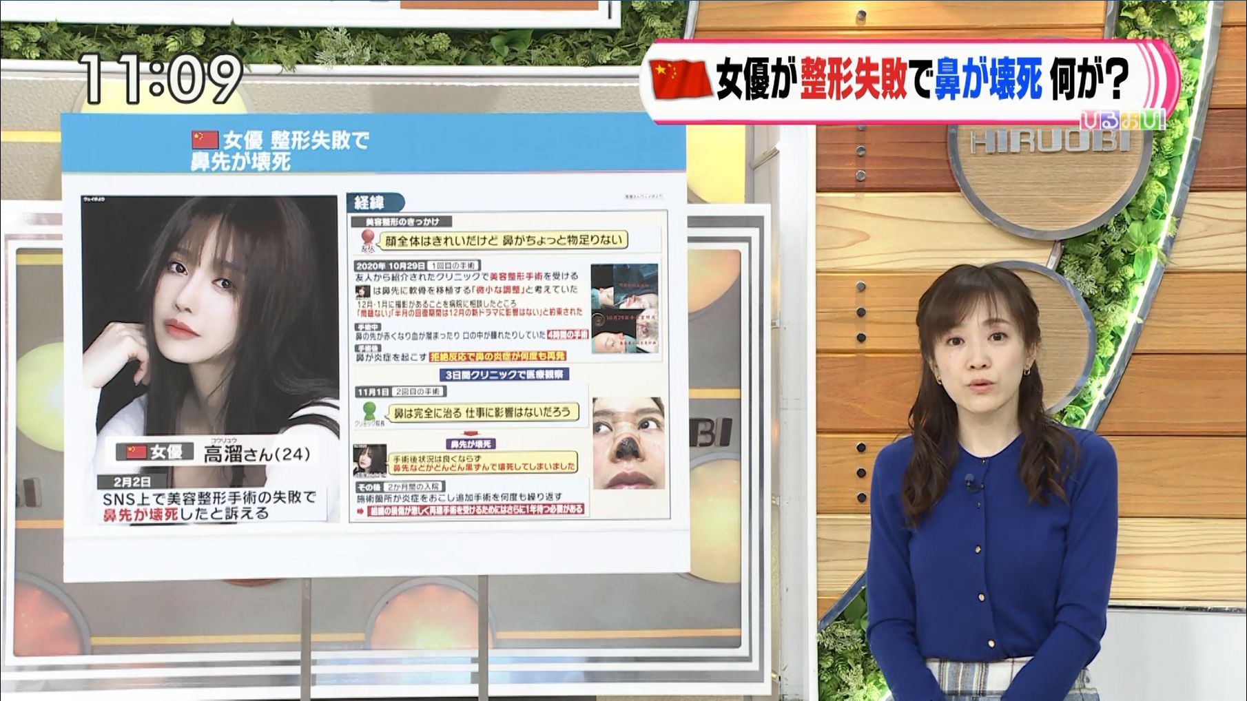江藤愛 ひるおび 21 02 09 女子アナキャプでも貼っておく Optimistic Attraction 江藤愛 ひるおび 21 02 09 女子アナキャプでも貼っておく Optimistic Attraction