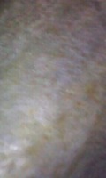Photo_5
