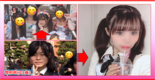 可愛い 白血病 女性アイドル 21歳 が整形 ˊᵕˋ ੭