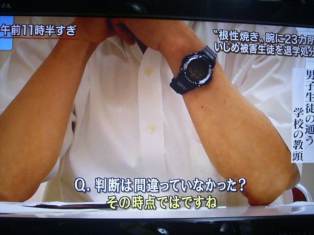 仙台育英 たばこ根性焼き火傷事件 被害者に自主退学を勧告 メディアの棚 仙台育英 たばこ根性焼き火傷事件 被害者に自主退学を勧告 メディアの棚
