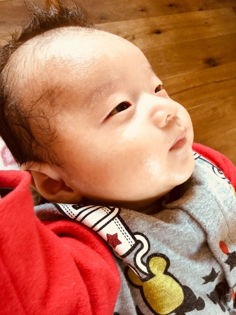 生後2カ月 首のただれ 7日目 プロペト軟膏 Meguのまいにち記録 4児ままの育児日記 生後2カ月 首のただれ 7日目 プロペト軟膏 Meguのまいにち記録 4児ままの育児日記