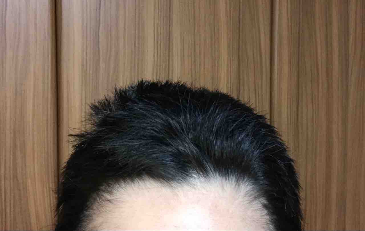 坊主女子への道 ついに決行したよー 工場勤務で100万円