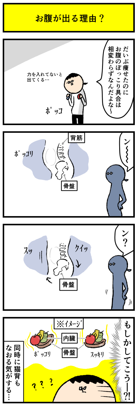 51+ 子宮 筋腫 お腹 ぽっこり 画像 34 お腹ぽっこりの謎に迫る : デルマな日常〜ちょっと皮膚科な話〜 Powered by ライブドアブログ