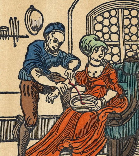 BLOODLETTING, 16th