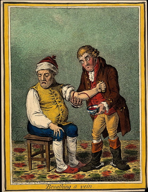 a caricature of bloodletting venesection James Gillray 1804