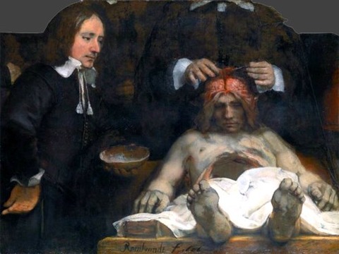 anatomy Lesson Dr. Deijman 1656 Rembrandt van Rijn