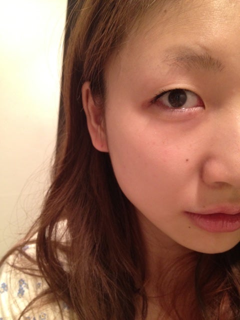 美容施術後「キレイになるって大変」と語るあいのり桃のビフォーアフター