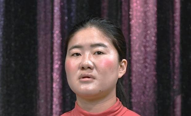 ガンバレルーヤよしこの顔が激変。脳の難病で失明の危機。