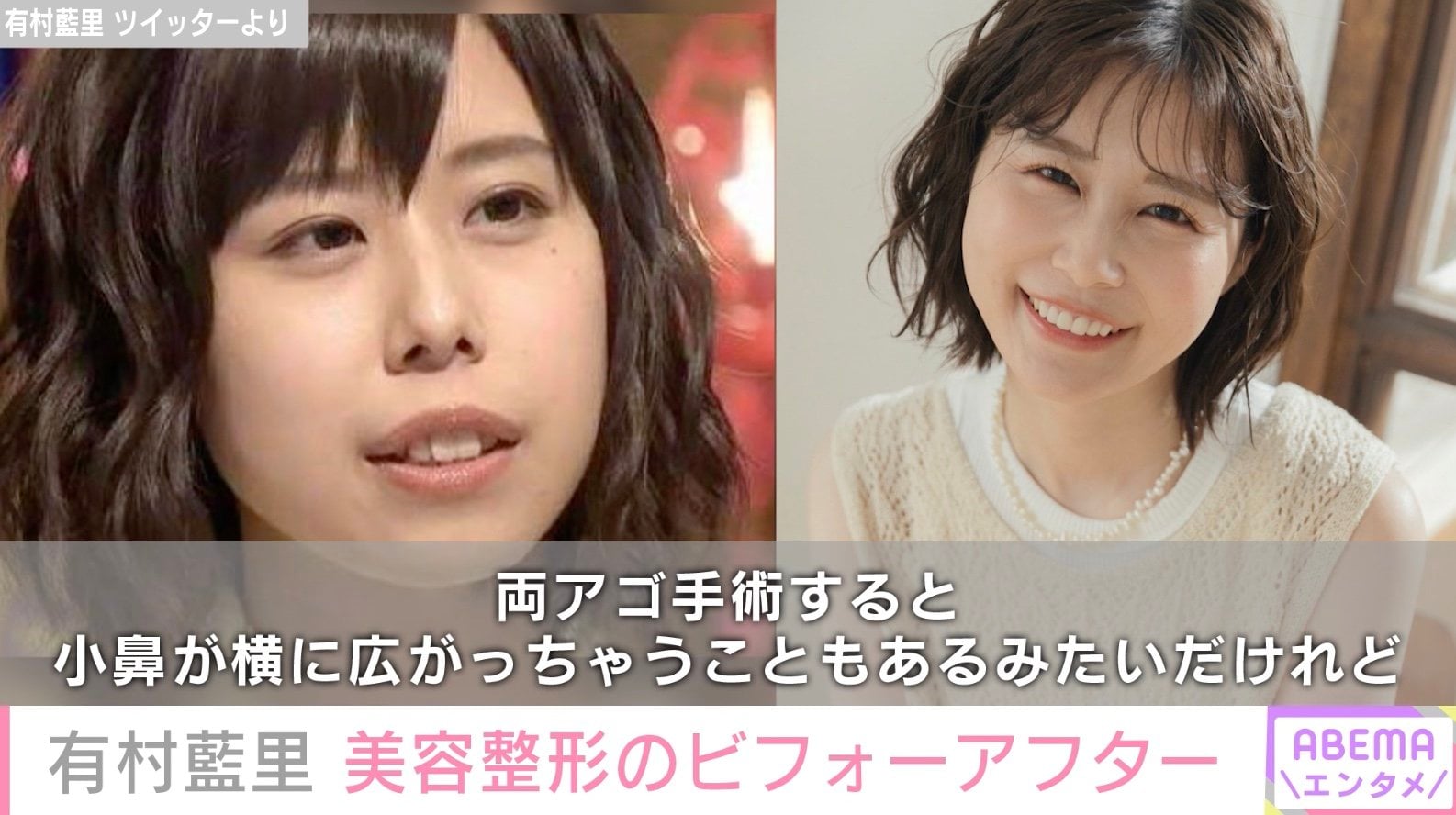 整形から５年、妹の有村架純に似た可愛い姉の最新姿とその背景