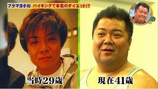 ブラマヨ小杉の健康危機と劇的な改善：睡眠無呼吸症候群の真実