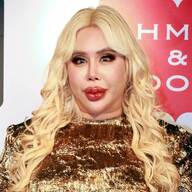 整形前→後のビフォーアフター写真！総額1億円をかけたアレン様。少年院卒も暴露