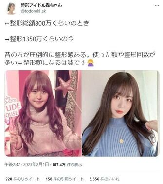 1350万円の整形アイドル轟ちゃんのビフォーアフター：夢がある！！