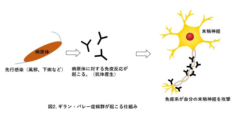 ギラン・バレー症候群診断のフリーマン三男、人工呼吸器外す　チーム離脱して看病