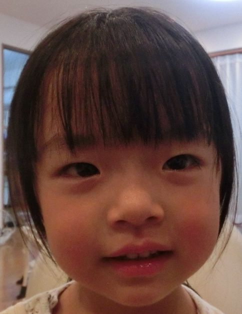 めぐちんの日記 りんご病確定 めぐちんの日記 りんご病確定