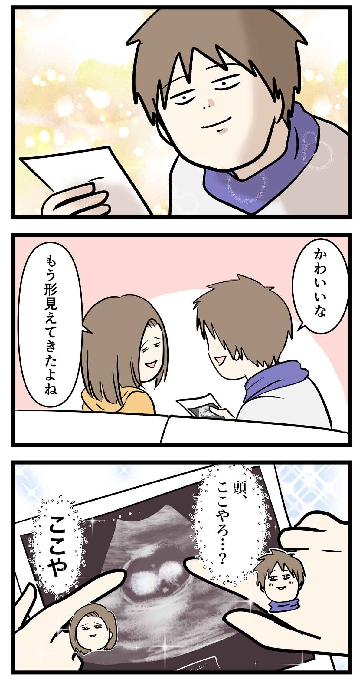 あ2157a