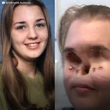 ����������� (15)