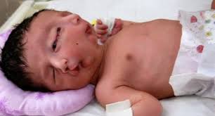 ����������� (20)