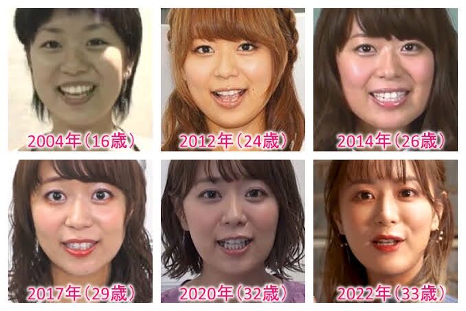 iguchi10