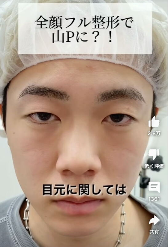 chee