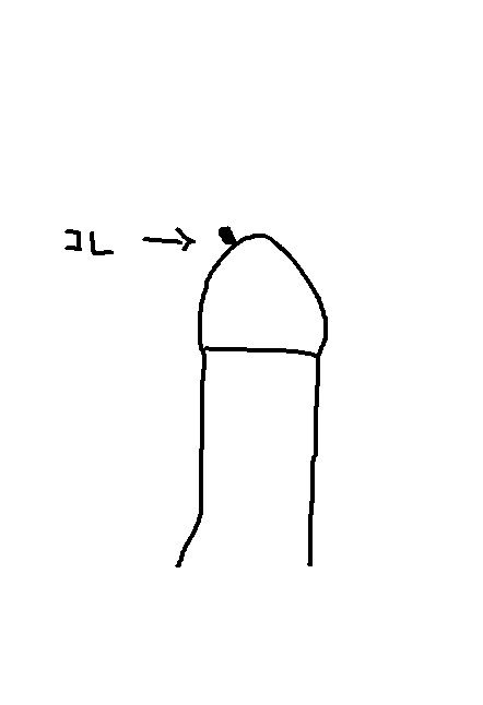 chinpo3