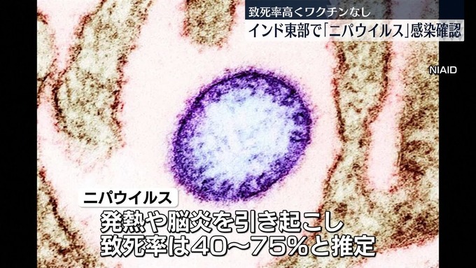 ワクチンも治療法もない致死率40～75%のヤバすぎる新型ウイルスが爆誕！！