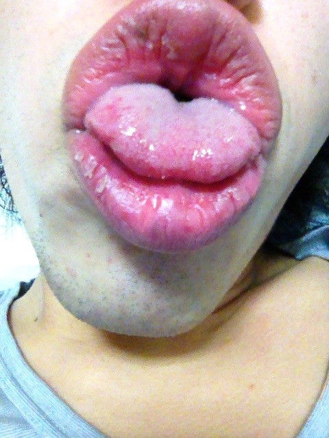 kissgao6