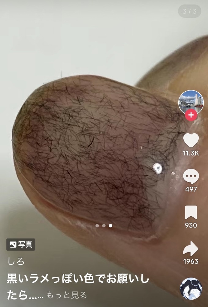 chin2