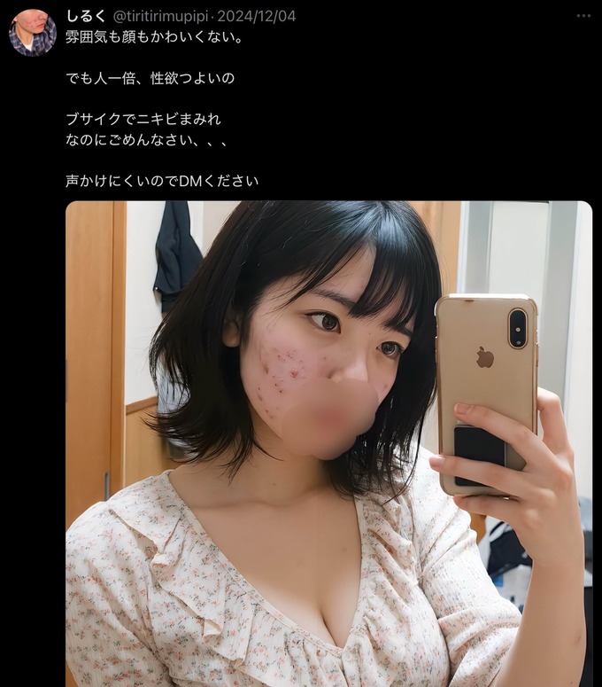【画像】ニキビ女「ニキビだらけでブサイクだけど、誰か抱いて。DMください。」