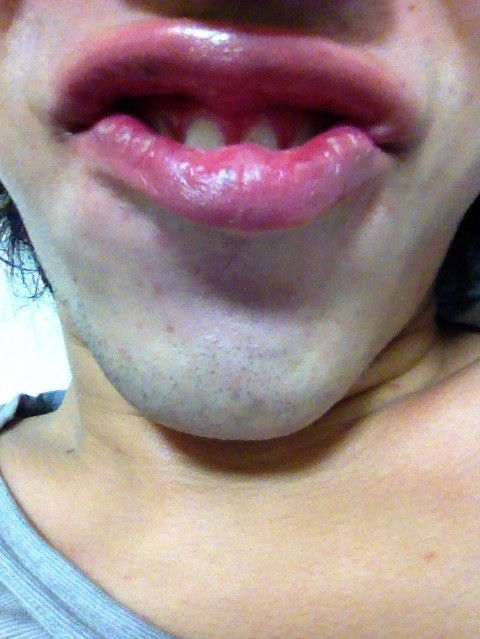 kissgao2