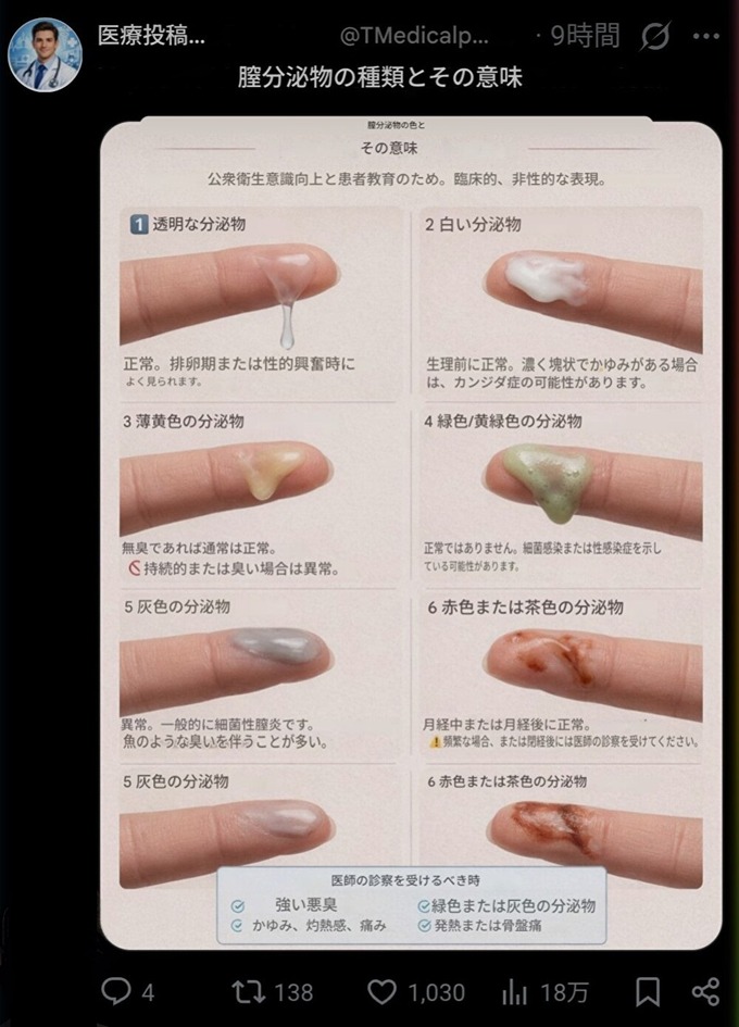 【画像】女の子が膣から分泌する液体がこちらです