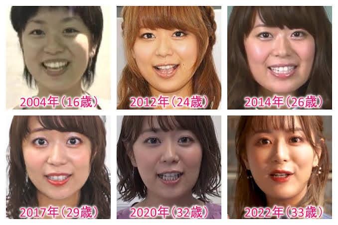 iguchi9