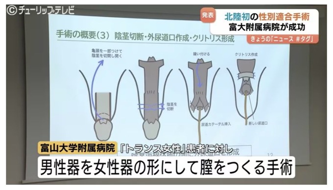 【悲報】マ●コの作り方、テレビ放送されてしまう