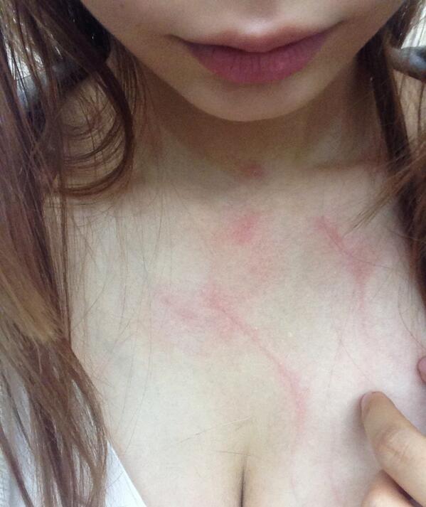 shoko