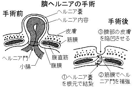 kosugi2