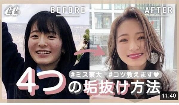 【画像】芋臭い東大生の女の子、垢抜けて超絶美女になるｗｗｗｗｗｗ