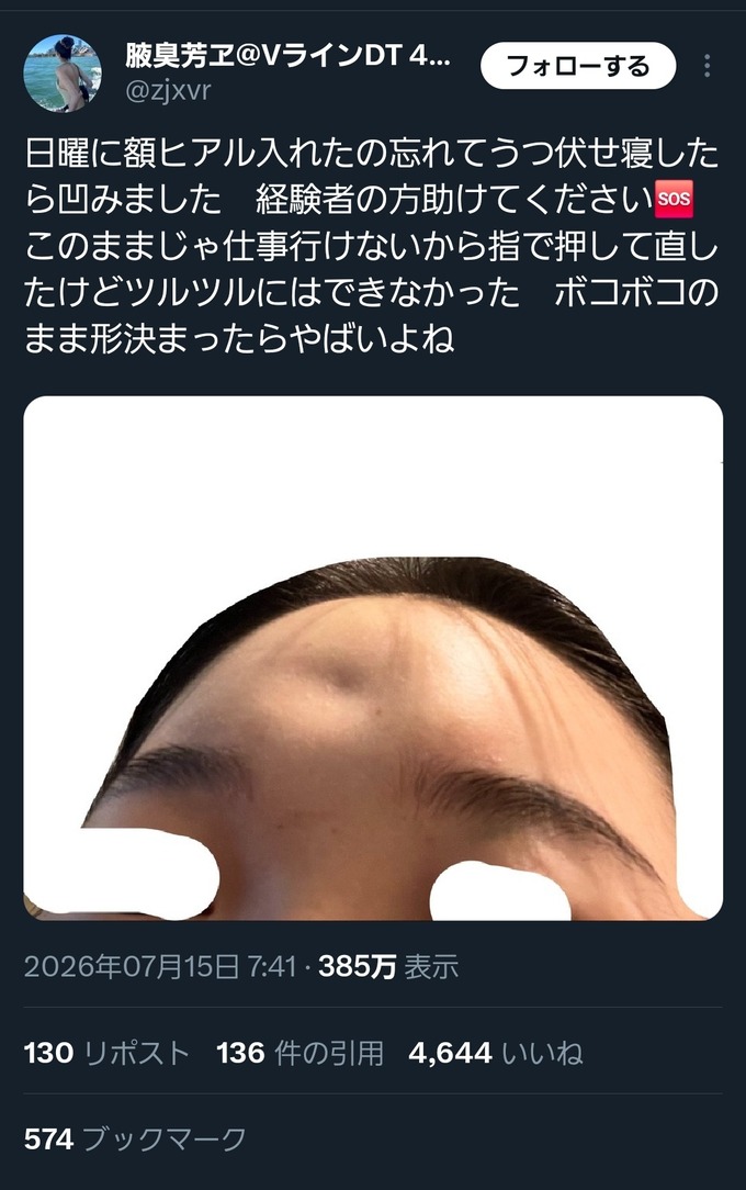 hekomu